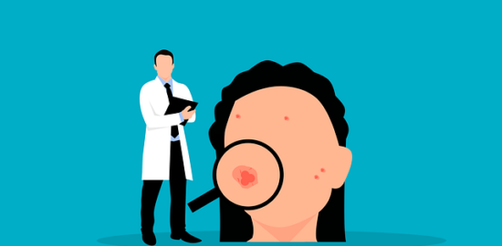 Akné: Praktické rady a informace