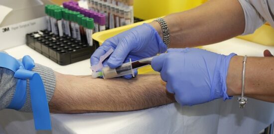 Prevence a léčba akné: informace a rady