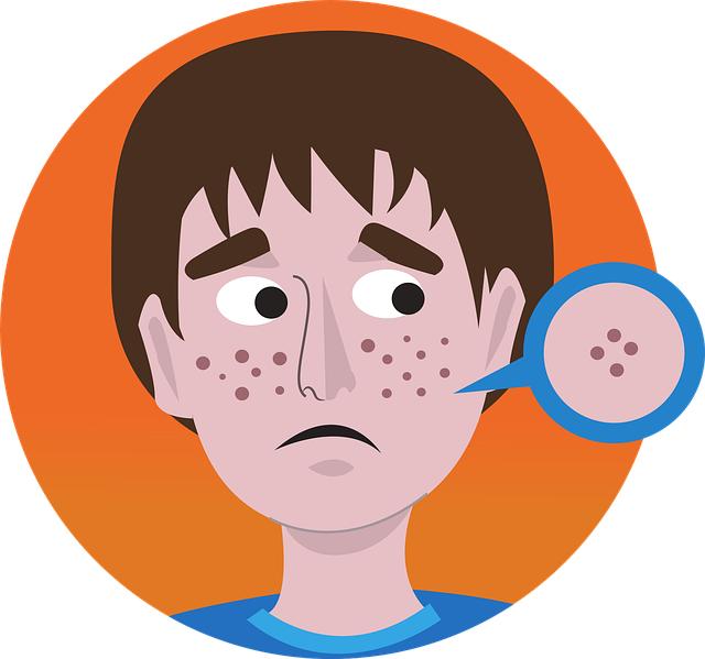 Akné a jeho účinná léčba pomocí moderních metod