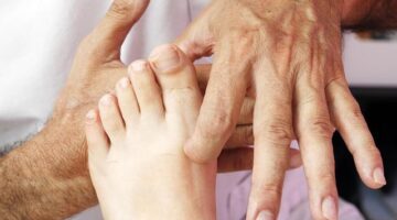 Jak léčit artrózu pomocí přírodních prostředků