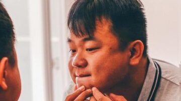 Jak se zbavit akné – Neutrální článek o možnostech léčby a prevence problémů s akné