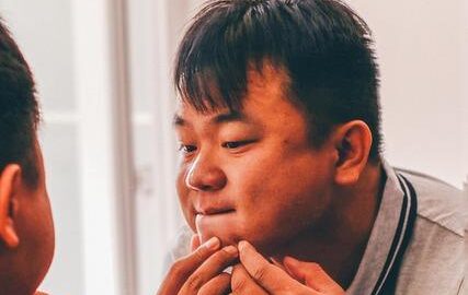 Jak se zbavit akné – Neutrální článek o možnostech léčby a prevence problémů s akné